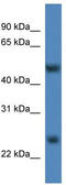 Methyltransferase Like 4 antibody, TA346820, Origene, Western Blot image 