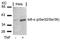 NFKB Inhibitor Alpha antibody, AP02436PU-N, Origene, Western Blot image 