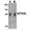 Transcription Factor EB antibody, MBS150693, MyBioSource, Western Blot image 