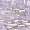 POU domain, class 3, transcription factor 3 antibody, HPA067151, Atlas Antibodies, Immunohistochemistry paraffin image 