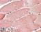 Tripartite Motif Containing 7 antibody, 45-684, ProSci, Immunohistochemistry paraffin image 