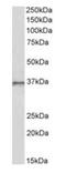 Homeobox C10 antibody, orb146470, Biorbyt, Western Blot image 
