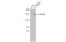 SET Domain Bifurcated Histone Lysine Methyltransferase 1 antibody, GTX110219, GeneTex, Western Blot image 