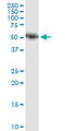 Amylase Alpha 1C (Salivary) antibody, LS-B6374, Lifespan Biosciences, Western Blot image 