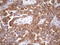 Charged multivesicular body protein 5 antibody, LS-C799007, Lifespan Biosciences, Immunohistochemistry paraffin image 