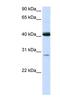 Glutaryl-CoA Dehydrogenase antibody, NBP1-54641, Novus Biologicals, Western Blot image 