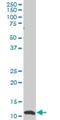 Small Nuclear RNA Activating Complex Polypeptide 5 antibody, H00010302-M02, Novus Biologicals, Western Blot image 