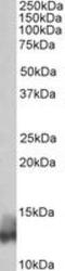 Phospholamban antibody, NBP1-49852, Novus Biologicals, Western Blot image 