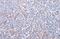 IL2 Inducible T Cell Kinase antibody, GTX636666, GeneTex, Immunohistochemistry paraffin image 