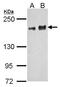 KDM6B antibody, PA5-32192, Invitrogen Antibodies, Western Blot image 