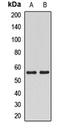 Megakaryocyte-Associated Tyrosine Kinase antibody, LS-C667892, Lifespan Biosciences, Western Blot image 