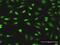 Phosphate Cytidylyltransferase 1, Choline, Alpha antibody, H00005130-M02, Novus Biologicals, Immunocytochemistry image 