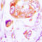 Casein Kinase 1 Alpha 1 antibody, LS-C353957, Lifespan Biosciences, Immunohistochemistry paraffin image 