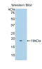 TNF Receptor Superfamily Member 21 antibody, LS-C296881, Lifespan Biosciences, Western Blot image 