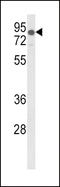 Low Density Lipoprotein Receptor antibody, LS-C165735, Lifespan Biosciences, Western Blot image 