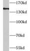 Leucine-rich repeats and immunoglobulin-like domains protein 1 antibody, FNab09953, FineTest, Western Blot image 