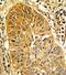 Caldesmon 1 antibody, GTX81812, GeneTex, Immunohistochemistry paraffin image 