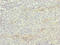 Zinc Finger And BTB Domain Containing 48 antibody, LS-C676728, Lifespan Biosciences, Immunohistochemistry paraffin image 