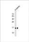 Nuclear Factor, Erythroid 4 antibody, PA5-49450, Invitrogen Antibodies, Western Blot image 