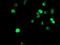 Methyltransferase Like 16 antibody, MA5-25956, Invitrogen Antibodies, Immunocytochemistry image 