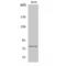 Potassium Voltage-Gated Channel Subfamily Q Member 4 antibody, LS-C384246, Lifespan Biosciences, Western Blot image 