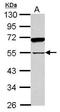 Sperm-associated antigen 8 antibody, GTX119963, GeneTex, Western Blot image 