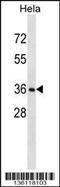 Ring Finger Protein 34 antibody, 58-611, ProSci, Western Blot image 