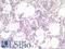 Mesothelin antibody, LS-A12008, Lifespan Biosciences, Immunohistochemistry paraffin image 