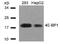 Eukaryotic Translation Initiation Factor 4E Binding Protein 1 antibody, 79-368, ProSci, Western Blot image 