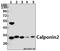 Calponin 2 antibody, A08680-1, Boster Biological Technology, Western Blot image 