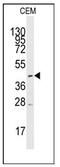 Monocarboxylate transporter 1 antibody, AP12389PU-N, Origene, Western Blot image 