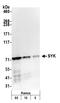 Spleen Associated Tyrosine Kinase antibody, A300-559A, Bethyl Labs, Western Blot image 