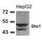 SHC-transforming protein 1 antibody, A00796-1, Boster Biological Technology, Western Blot image 