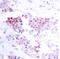 Myocyte Enhancer Factor 2A antibody, AP02582PU-N, Origene, Immunohistochemistry paraffin image 