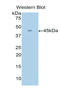 Troponin C2, Fast Skeletal Type antibody, LS-C300884, Lifespan Biosciences, Western Blot image 