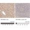 Protein Phosphatase 1 Regulatory Subunit 3B antibody, NBP1-82243, Novus Biologicals, Immunohistochemistry paraffin image 