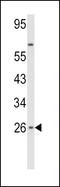 Interferon Beta 1 antibody, LS-C165130, Lifespan Biosciences, Western Blot image 