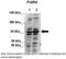 Poly(A)-Specific Ribonuclease antibody, 28-665, ProSci, Western Blot image 