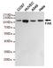 Protein Tyrosine Kinase 2 antibody, STJ99191, St John