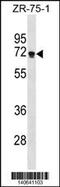 Zinc finger protein 654 antibody, 60-660, ProSci, Western Blot image 