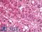 Kruppel Like Factor 7 antibody, LS-C200839, Lifespan Biosciences, Immunohistochemistry paraffin image 