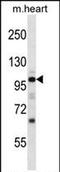 Natriuretic Peptide Receptor 1 antibody, PA5-71876, Invitrogen Antibodies, Western Blot image 