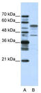 Basic Leucine Zipper Nuclear Factor 1 antibody, TA343420, Origene, Western Blot image 