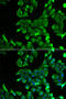 Stomatin antibody, STJ28455, St John