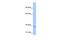 NOP2/Sun RNA Methyltransferase 3 antibody, GTX46175, GeneTex, Western Blot image 