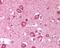 Cyclin Dependent Kinase 2 antibody, 48-689, ProSci, Immunohistochemistry paraffin image 