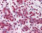 Vitamin D Receptor antibody, 51-525, ProSci, Immunohistochemistry frozen image 