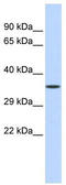 Zinc Finger Protein 124 antibody, TA343394, Origene, Western Blot image 