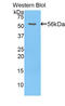 Hepatocyte growth factor activator antibody, LS-C298655, Lifespan Biosciences, Western Blot image 