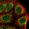 Protein Only RNase P Catalytic Subunit antibody, HPA020459, Atlas Antibodies, Immunocytochemistry image 